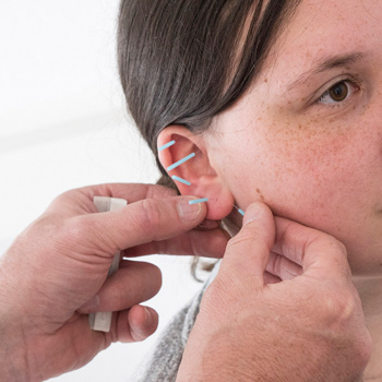 Dr. Peter Steinkamp | Akupunktur Koblenz